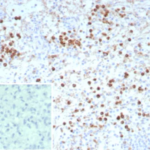 Formalin-fixed, paraffin-embedded human spleen stained with CD63 Recombinant Mouse Monoclonal Antibody (rLAMP3/9131). Inset: PBS instead of primary antibody; secondary only negative control.