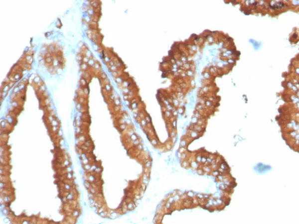 Formalin-fixed, paraffin-embedded human prostate stained with CD63 Recombinant Rabbit Monoclonal Antibody (LAMP3/8248R). HIER: Tris/EDTA, pH9.0, 45min. 2°C: HRP-polymer, 30min. DAB, 5min.