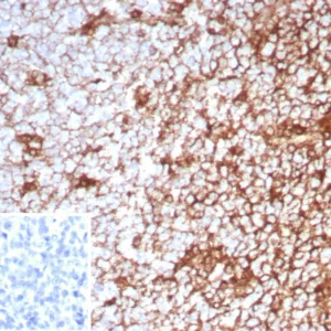 Formalin-fixed, paraffin-embedded human tonsil stained with CD63 Recombinant Rabbit Monoclonal Antibody (LAMP3/8799R). Inset: PBS instead of primary antibody; secondary only negative control.