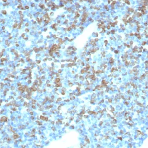 Formalin-fixed, paraffin-embedded human tonsil stained with CD74 Mouse Monoclonal Antibody (CLIP/7946) at 2ug/ml. HIER: Tris/EDTA, pH9.0, 45min. 2°C: HRP-polymer, 30min. DAB, 5min.