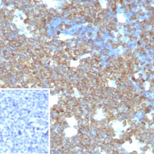 Formalin-fixed, paraffin-embedded human tonsil stained with CD74 Recombinant Rabbit Monoclonal Antibody (CLIP/8680R). Inset: PBS instead of primary antibody; secondary only negative control.