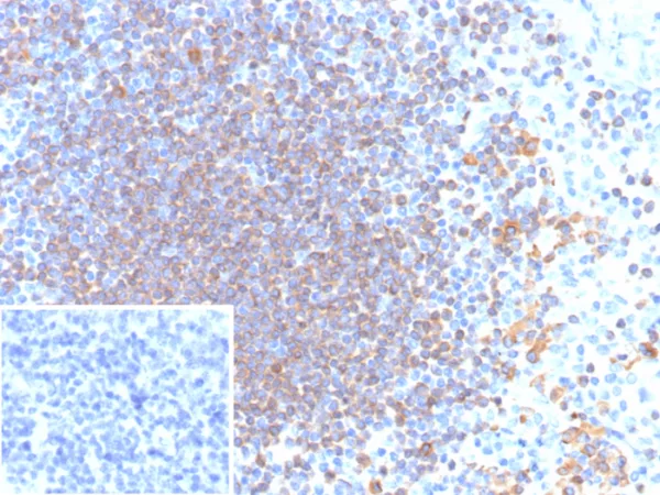 Formalin-fixed, paraffin-embedded human tonsil stained with CD79a Recombinant Mouse Monoclonal Antibody (rIGA/6986). Inset: PBS instead of primary antibody; secondary only negative control.