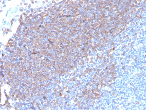Formalin-fixed, paraffin-embedded human tonsil stained with CD79a Recombinant Mouse Monoclonal Antibody (rIGA/6986). HIER: Tris/EDTA, pH9.0, 45min. 2: HRP-polymer, 30min. DAB, 5min.