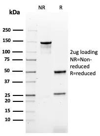 SDS-PAGE Analysis  Purified CD79b Mouse Monoclonal Antibody (CD79b/4960). Confirmation of Integrity and Purity of Antibody.