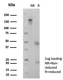 SDS-PAGE Analysis of Purified ZSCAN12 Mouse Monoclonal Antibody (PCRP-ZSCAN12-2B2). Confirmation of Purity and Integrity of Antibody.