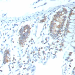 Formalin-fixed, paraffin-embedded human colon stained with CD151 Recombinant Rabbit Monoclonal Antibody (CD151/9297R). HIER: Tris/EDTA, pH9.0, 45min. 2°C: HRP-polymer, 30min. DAB, 5min.