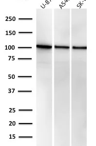 Western blot analysis of U-87, A549 & SK-BR3 cell lysate using MVP Recombinant Mouse Monoclonal Antibody (r1032).