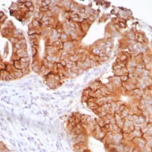 Formalin-fixed, paraffin-embedded human colon stained with  VEGI Rabbit Recombinant Monoclonal Antibody (VEGI /7799R). HIER: Tris/EDTA, pH9.0, 45min. 2°C: HRP-polymer, 30min. DAB, 5min.