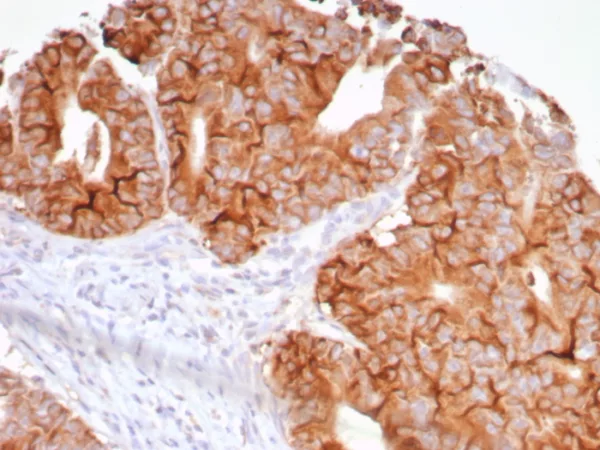 Formalin-fixed, paraffin-embedded human colon stained with  VEGI Rabbit Recombinant Monoclonal Antibody (VEGI /7799R). HIER: Tris/EDTA, pH9.0, 45min. 2°C: HRP-polymer, 30min. DAB, 5min.