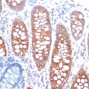 Formalin-fixed, paraffin-embedded human colon stained with E-Cadherin Recombinant Mouse Monoclonal Antibody (rCDH1/6769). Inset: PBS instead of primary antibody; secondary only negative control.