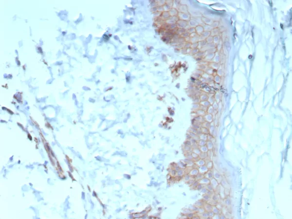 Formalin-fixed, paraffin-embedded human skin stained with Pan-Cadherin Mouse Monoclonal Antibody (Pan-CAD/8020). HIER: Tris/EDTA, pH9.0, 45min. 2°C: HRP-polymer, 30min. DAB, 5min.