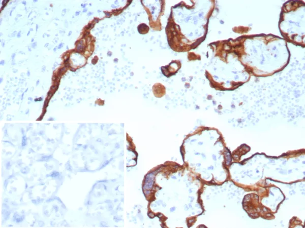 Formalin-fixed, paraffin-embedded human placenta stained with CK, LMW Recombinant Mouse Monoclonal Antibody (rKRTL/8751). Inset: PBS instead of primary antibody; secondary only negative control.