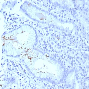 Formalin-fixed, paraffin-embedded human H. pylori-infected stomach stained with H. pylori Recombinant Rabbit Monoclonal Antibody (HPYL/8575R). HIER: Tris/EDTA, pH9.0, 45min. 2°C: HRP-polymer, 30min. DAB, 5min.
