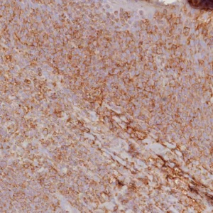 Formalin-fixed, paraffin-embedded human tonsil stained with HLA 1 ABC Recombinant Rabbit Monoclonal Antibody (MHC-I/8147R). HIER: Tris/EDTA, pH9.0, 45min. 2: HRP-polymer, 30min. DAB, 5min.