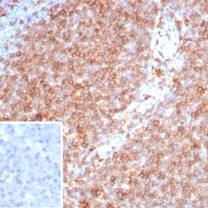 Formalin-fixed, paraffin-embedded human tonsil stained with HLA-Pan Rabbit Recombinant Monoclonal Antibody (HLA-Pan/8311R). Inset: PBS instead of primary antibody; secondary only negative control.