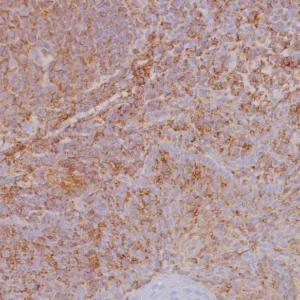 Formalin-fixed, paraffin-embedded human tonsil stained with HLA 1 ABC Recombinant Rabbit Monoclonal Antibody (MHC-I/8366R). HIER: Tris/EDTA, pH9.0, 45min. 2: HRP-polymer, 30min. DAB, 5min.