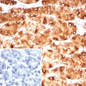 Formalin-fixed, paraffin-embedded human stomach stained with Lewis Y Recombinant Rabbit Monoclonal Antibody (LWY/9243R). Inset: PBS instead of primary antibody; secondary only negative control.