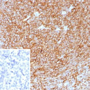 Formalin-fixed, paraffin-embedded human tonsil stained with HLA-Pan Rabbit Recombinant Monoclonal Antibody (HLA-Pan/8622R). Inset: PBS instead of primary antibody; secondary only negative control.