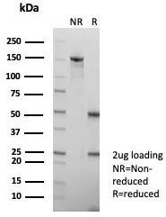 SDS-PAGE Analysis of Purified HBsAg Recombinant Rabbit Monoclonal Antibody (HBsAG/7666R). Confirmation of Purity and Integrity of Antibody.
