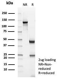 SDS-PAGE Analysis of Purified MSA Recombinant Rabbit Monoclonal Antibody (MSA/8949R). Confirmation of Purity and Integrity of Antibody.