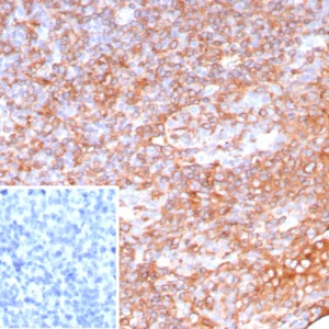 Formalin-fixed, paraffin-embedded human tonsil stained with HLA-Pan Rabbit Recombinant Monoclonal Antibody (HLA-Pan/9268R). Inset: PBS instead of primary antibody; secondary only negative control.