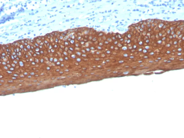 Formalin-fixed, paraffin-embedded human tonsil stained with Cytokeratin, pan Rabbit MonoPoly Antibody (MonoPoly/4999R).