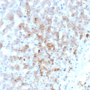 AKR1C1 Antibody in Immunohistochemistry (IHC (P))