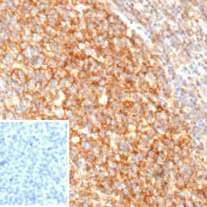 CD21 Antibody in Immunohistochemistry (IHC (P)).