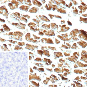 CPA1 Antibody in Immunohistochemistry (IHC (P))