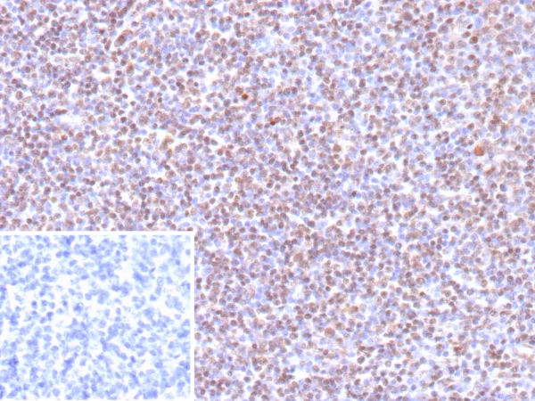 EBV Antibody in Immunohistochemistry (IHC (P))