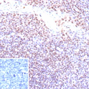 EBV Antibody in Immunohistochemistry (IHC (P))