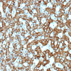 EPHB4 Antibody in Immunohistochemistry (IHC (P))