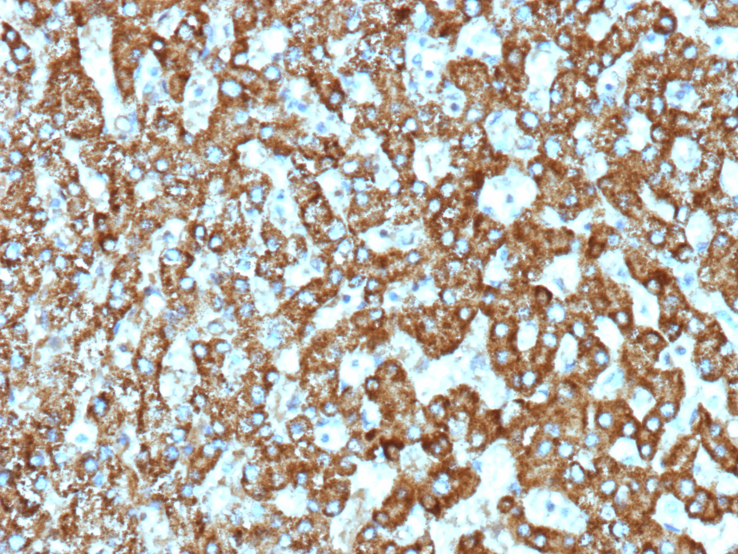 Formalin-fixed human liver stained with EPHB4 Recombinant Rabbit Monoclonal Antibody (EPHB4/9663R). HIER: Tris/EDTA, pH9.0, 45min. 2 °: HRP-polymer, 30min. DAB, 5min. EPHB4 Antibody in Immunohistochemistry (IHC (P))
