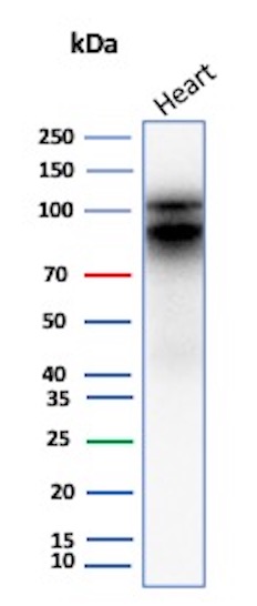 Western Blot Analysis of human heart tissue lysate using N-Cadherin Mouse Monoclonal Antibody (CDH2/9489).