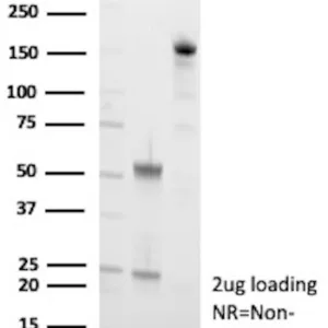 CDH2 Antibody in SDS-PAGE