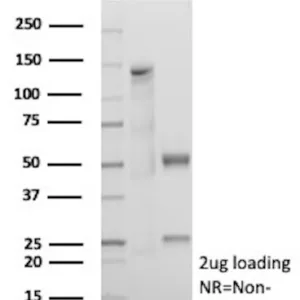 CDX2 Antibody in SDS-PAGE