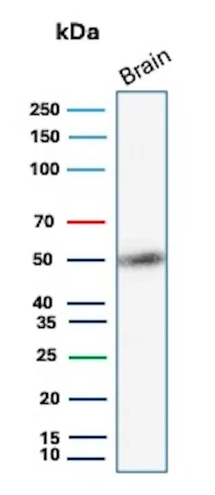 Western Blot Analysis of human brain tissue lysate using GFAP Mouse Monoclonal Antibody (GFAP/9424). GFAP Antibody in Western Blot (WB)