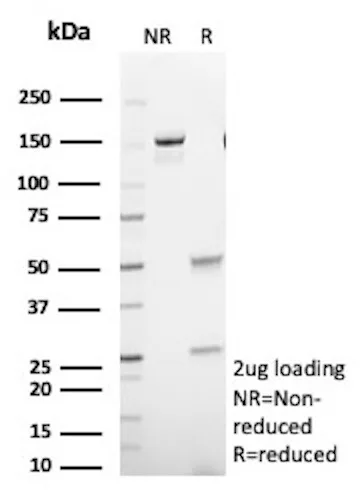 SDS-PAGE Analysis
Purified GFAP Mouse Monoclonal Antibody (GFAP/9424).
Confirmation of Purity and Integrity of Antibody.
GFAP Antibody in SDS-PAGE