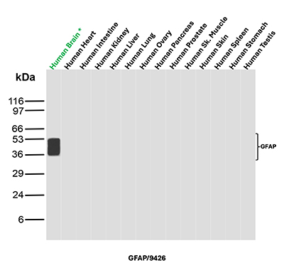Western Blot Analysis of Human Brain, Human Heart, Human Intestine, Human Kidney, Human Liver, Human Lung, Human Ovary, Human Pancreas, Human Prostrate, Human Skeletal Muscle, Human Skin, Human Spleen, Human Stomach and Human Testis tissue lysates using GFAP Recombinant Rabbit Monoclonal Antibody (GFAP/9426). GFAP Antibody in Western Blot (WB)