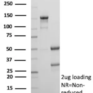 BIRC5 Antibody in SDS-PAGE