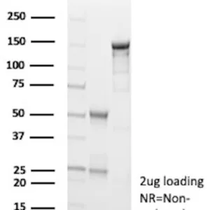 Survivin Antibody in SDS-PAGE