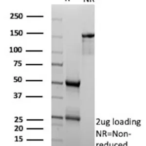 INHA Antibody in SDS-PAGE