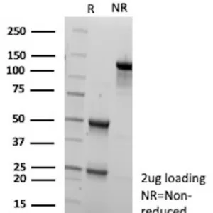 KNG1 Antibody in SDS-PAGE