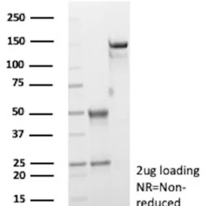Arginase-1 Antibody in SDS-PAGE