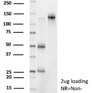 CD62-L Antibody in SDS-PAGE