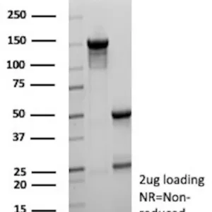 KLK4 Antibody in SDS-PAGE