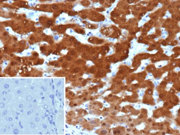 Arginase-1 Antibody in Immunohistochemistry (IHC (P))