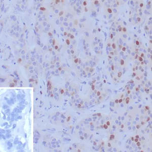 BRCA1 Antibody in Immunohistochemistry (IHC (P))