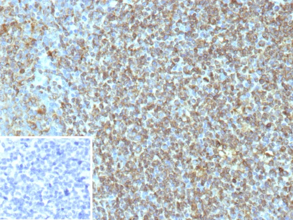 CD74 Antibody in Immunohistochemistry (IHC (P))