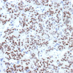 TTF1 Antibody in Immunohistochemistry (IHC (P))